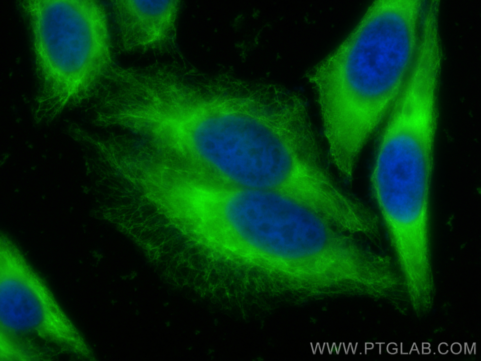 Immunofluorescence (IF) / fluorescent staining of HepG2 cells using Cytokeratin 18 Polyclonal antibody (10830-1-AP)