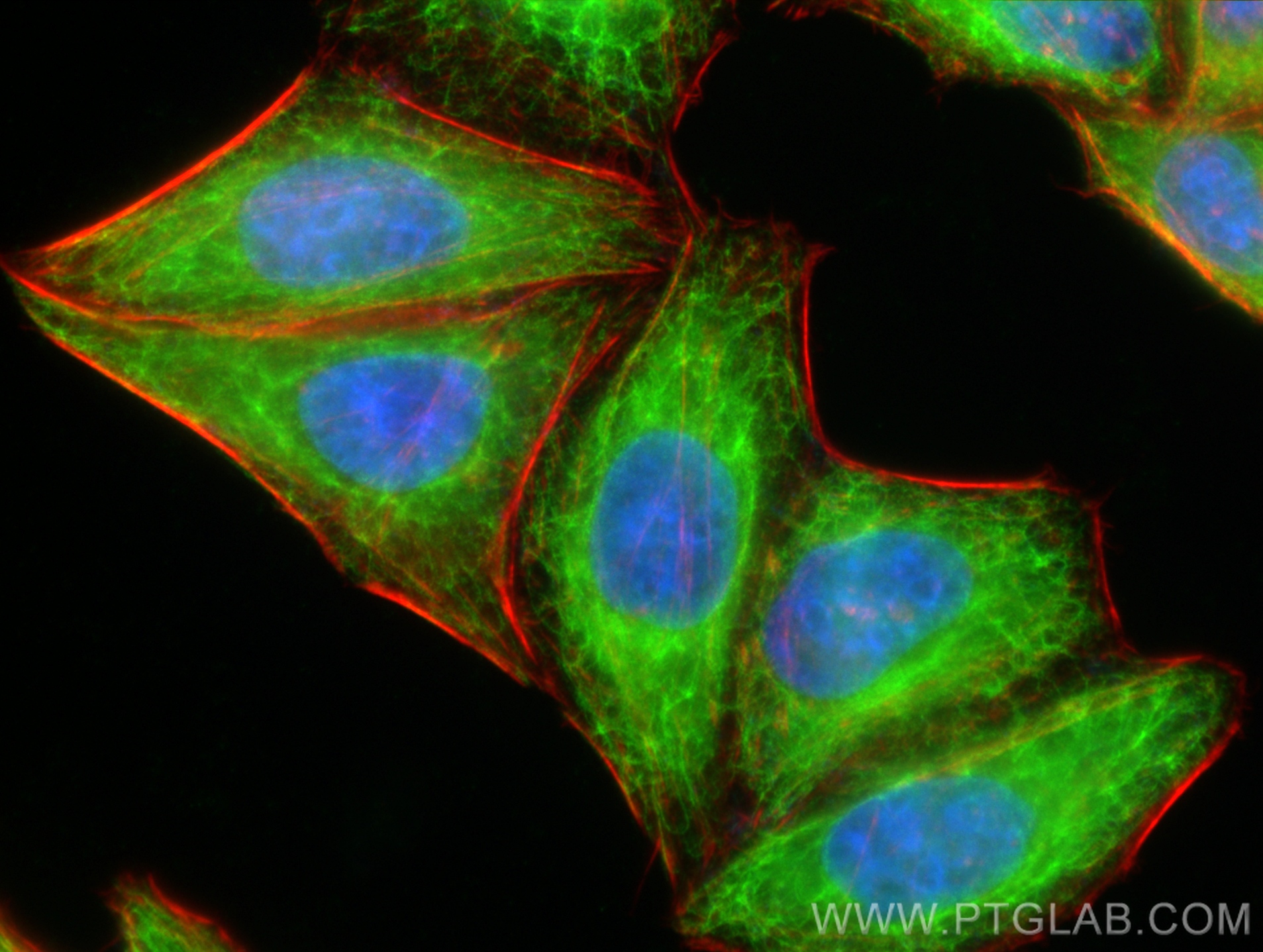 Immunofluorescence (IF) / fluorescent staining of HepG2 cells using Cytokeratin 18 Polyclonal antibody (10830-1-AP)