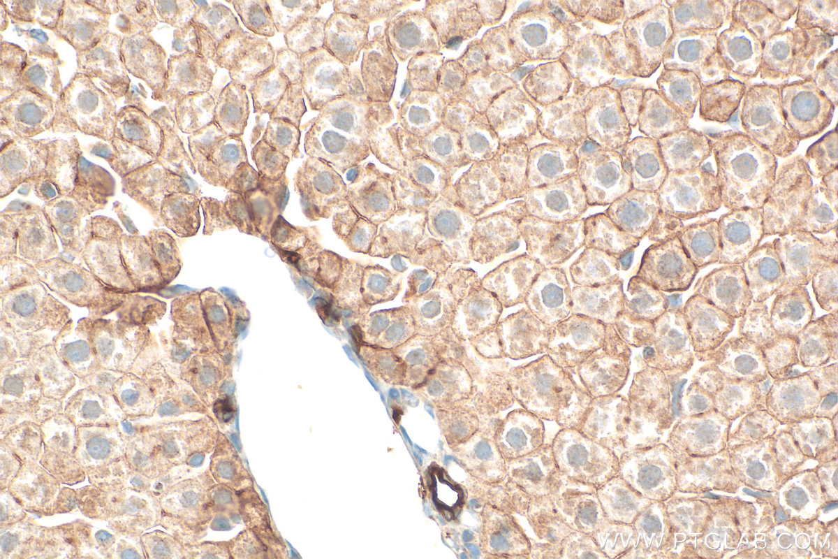 Immunohistochemistry (IHC) staining of rat liver tissue using Cytokeratin 18 Polyclonal antibody (10830-1-AP)