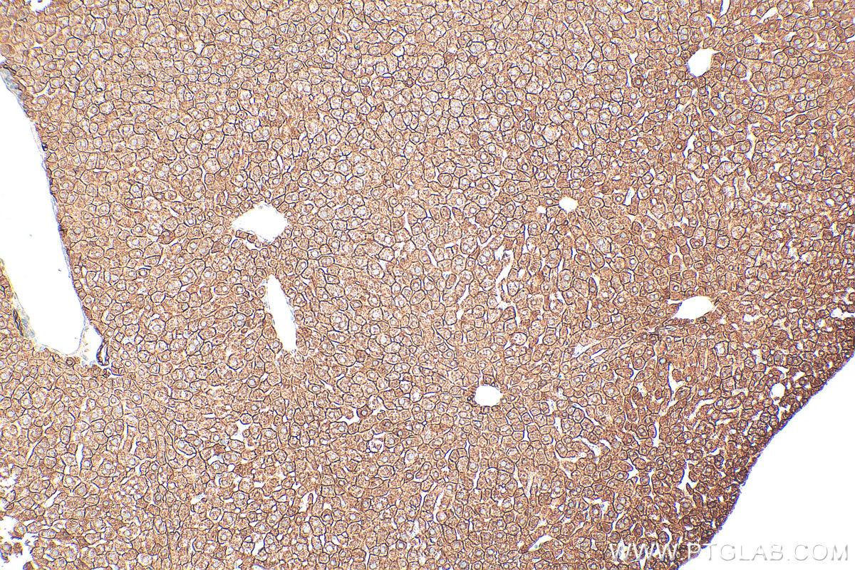 Immunohistochemistry (IHC) staining of mouse liver tissue using Cytokeratin 18 Polyclonal antibody (10830-1-AP)