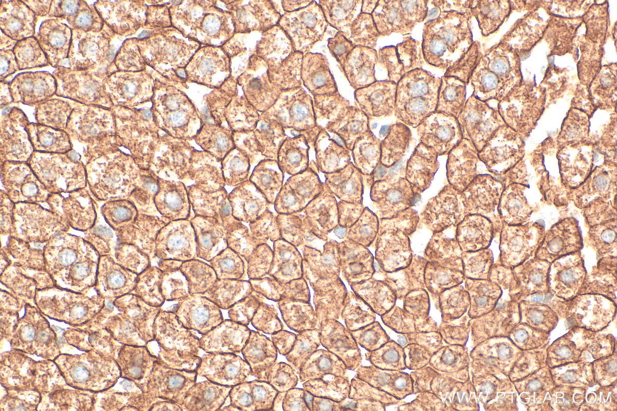 Immunohistochemistry (IHC) staining of mouse liver tissue using Cytokeratin 18 Polyclonal antibody (10830-1-AP)