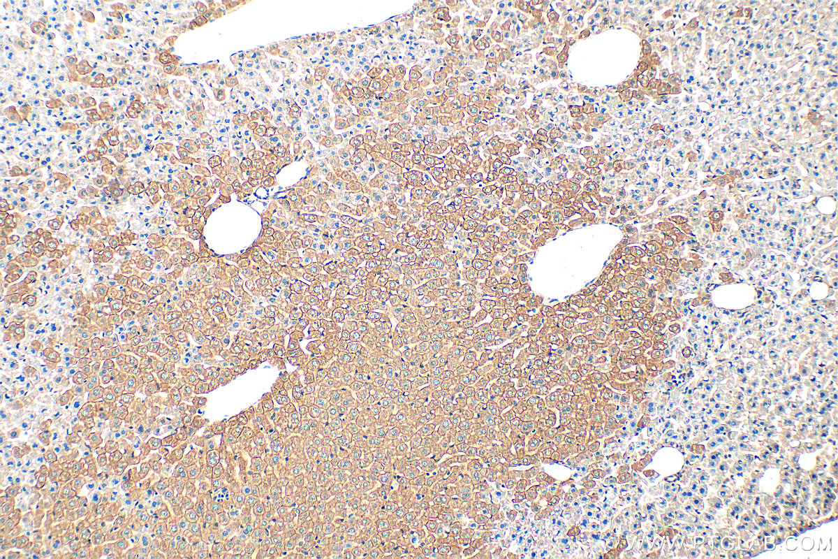 Immunohistochemistry (IHC) staining of mouse liver tissue using Cytokeratin 18 Polyclonal antibody (10830-1-AP)