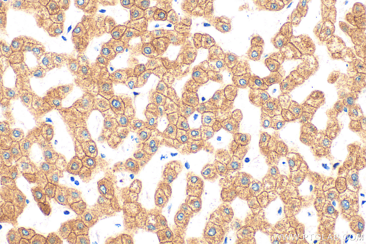 Immunohistochemistry (IHC) staining of human liver tissue using Cytokeratin 18 Polyclonal antibody (10830-1-AP)