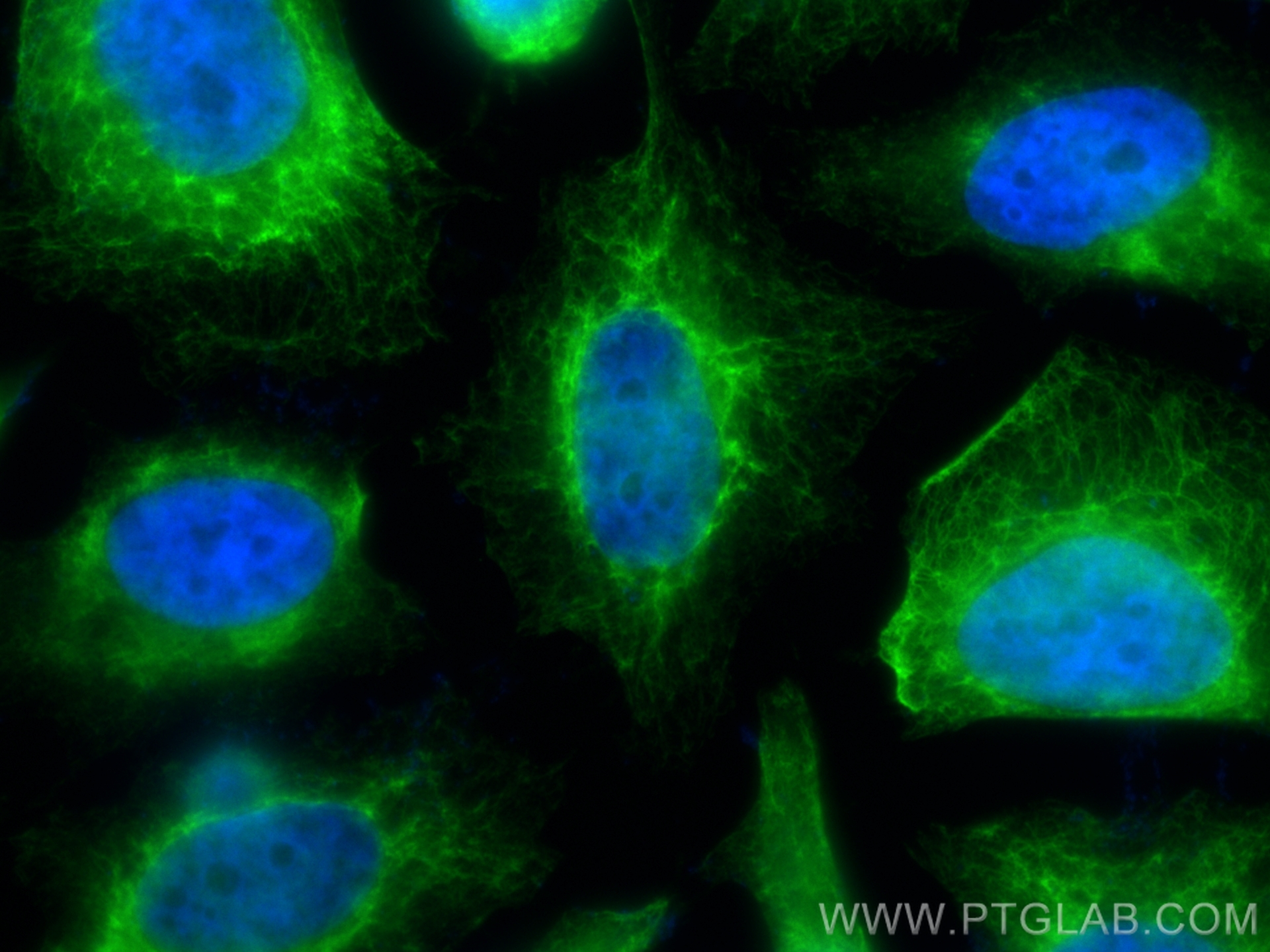 Immunofluorescence (IF) / fluorescent staining of HeLa cells using Cytokeratin 18 Monoclonal antibody (66187-1-Ig)