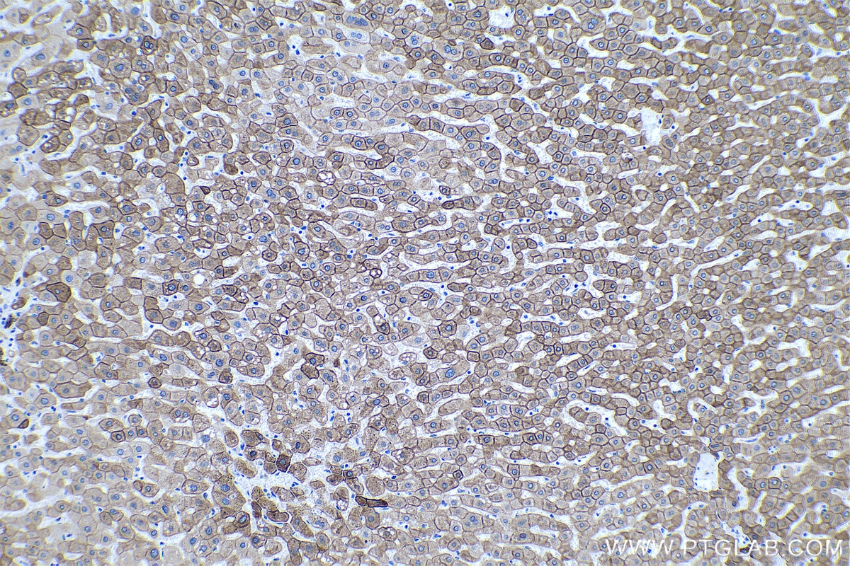 Immunohistochemistry (IHC) staining of human liver tissue using Cytokeratin 18 Monoclonal antibody (66187-1-Ig)