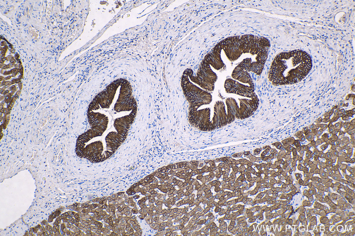 Immunohistochemistry (IHC) staining of human liver tissue using Cytokeratin 18 Monoclonal antibody (66187-1-Ig)