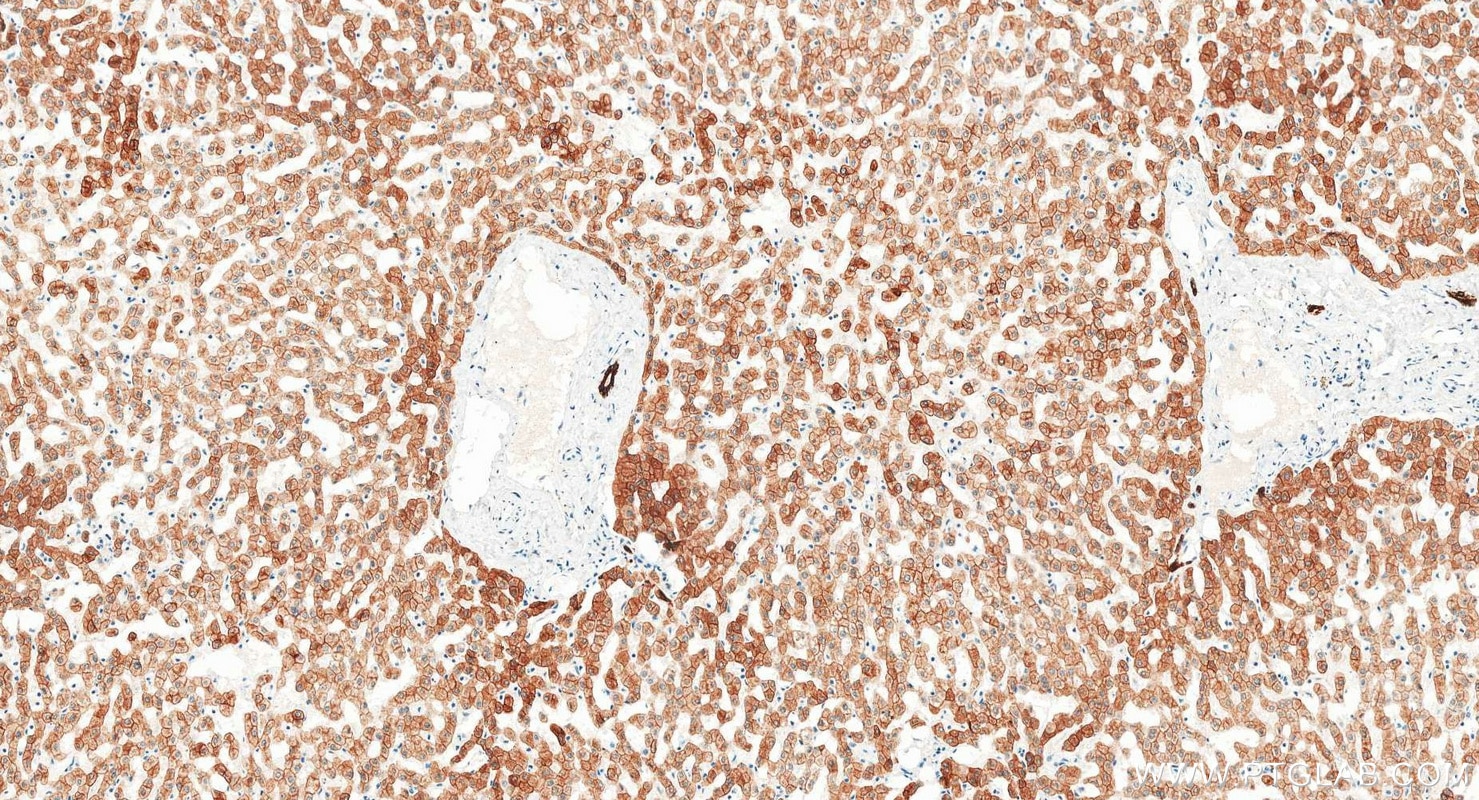 Immunohistochemistry (IHC) staining of human liver tissue using Cytokeratin 18 Monoclonal antibody (66187-1-Ig)