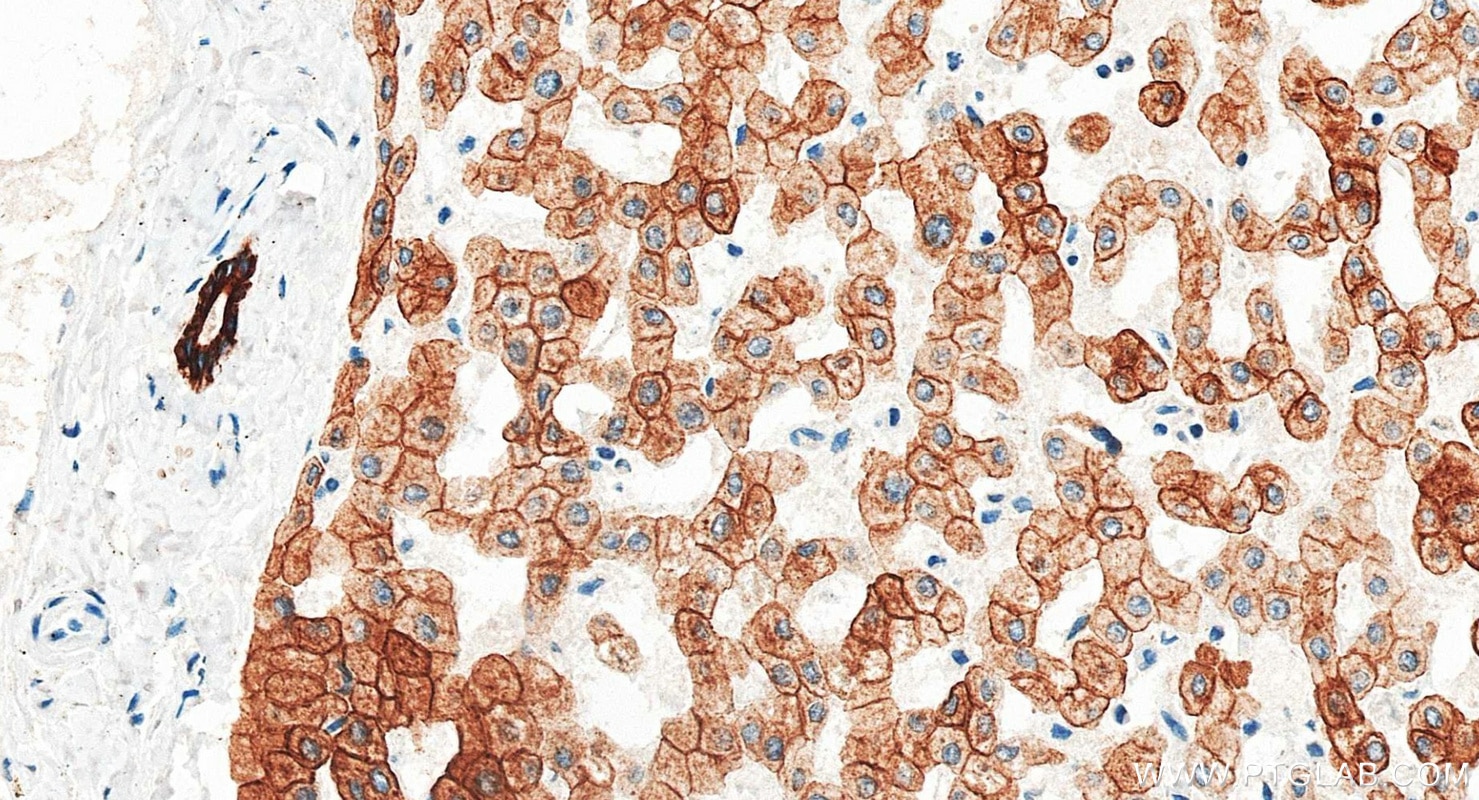 Immunohistochemistry (IHC) staining of human liver tissue using Cytokeratin 18 Monoclonal antibody (66187-1-Ig)