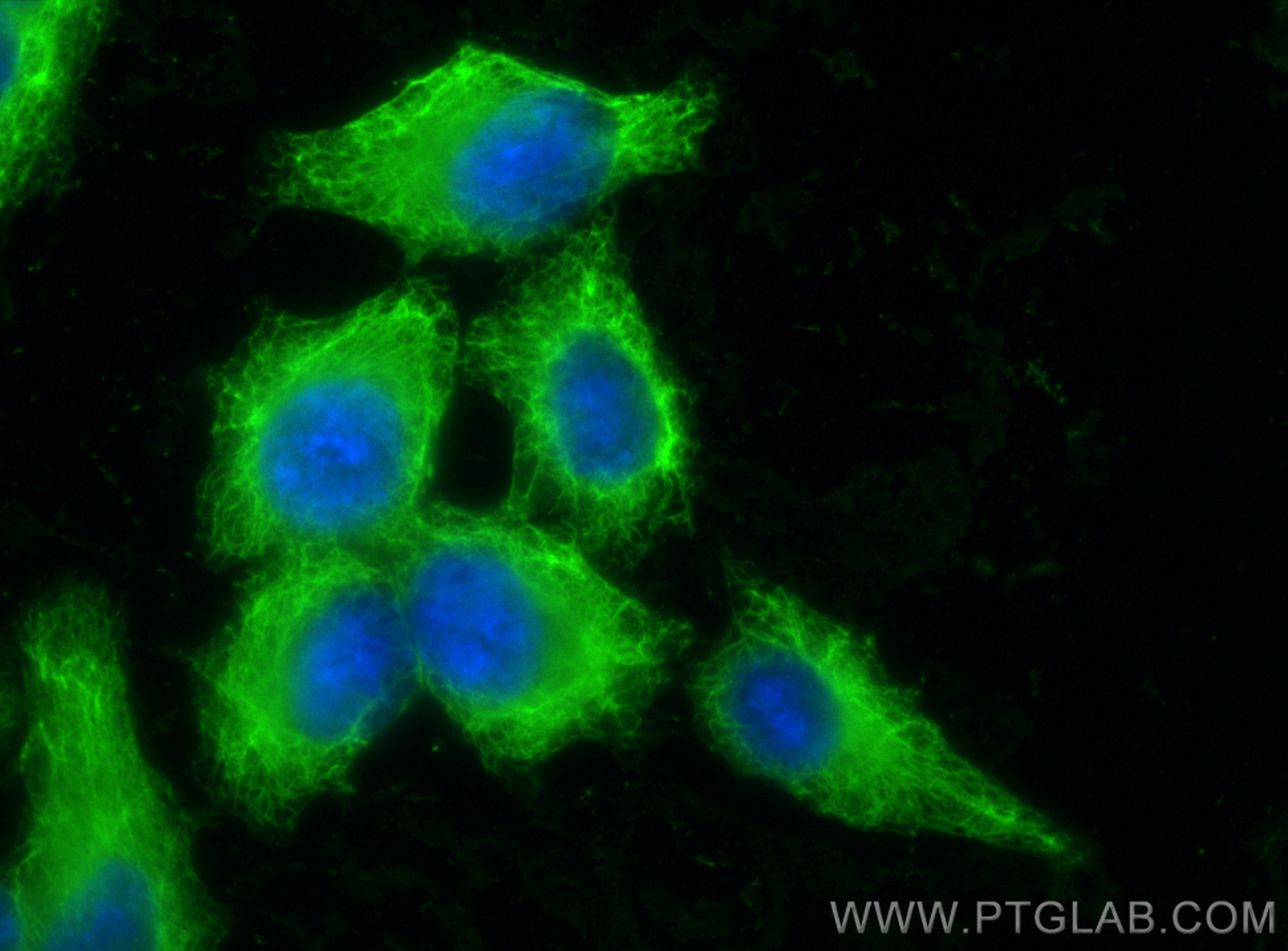 Immunofluorescence (IF) / fluorescent staining of HepG2 cells using Cytokeratin 18 Recombinant antibody (82817-5-RR)