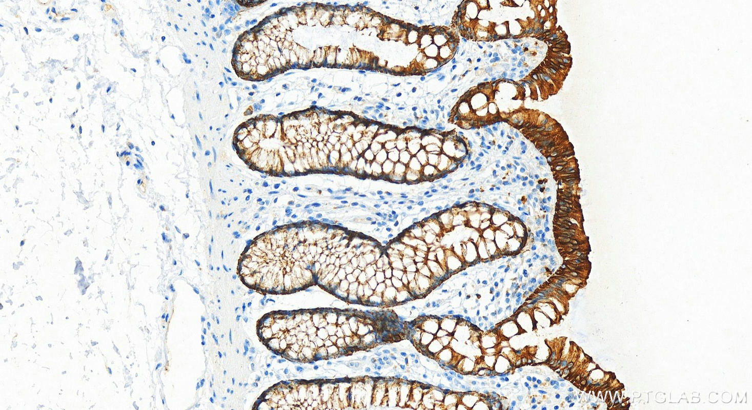 Immunohistochemistry (IHC) staining of human colon tissue using Cytokeratin 19 Polyclonal antibody (10712-1-AP)