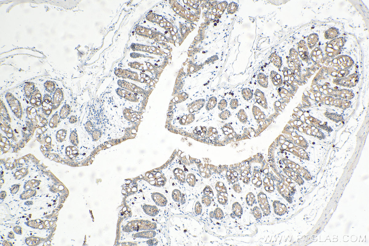 Immunohistochemistry (IHC) staining of mouse colon tissue using Cytokeratin 19 Polyclonal antibody (10712-1-AP)