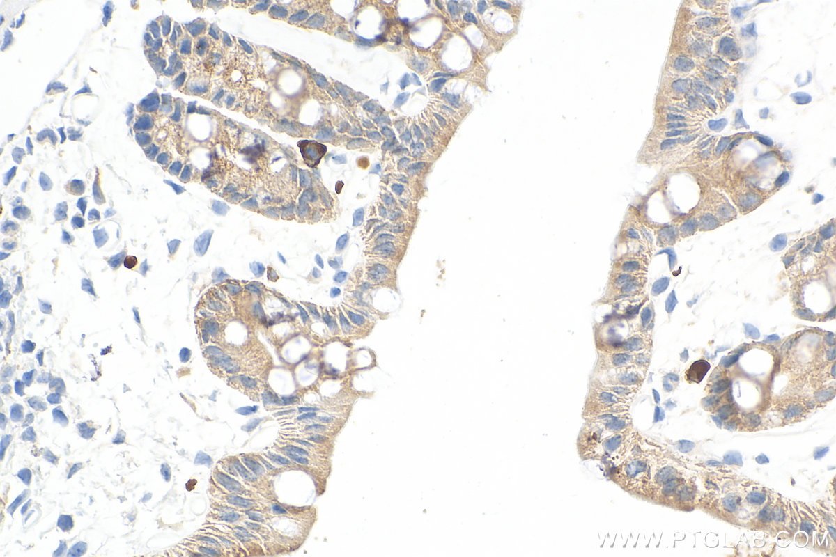 Immunohistochemistry (IHC) staining of mouse colon tissue using Cytokeratin 19 Polyclonal antibody (10712-1-AP)