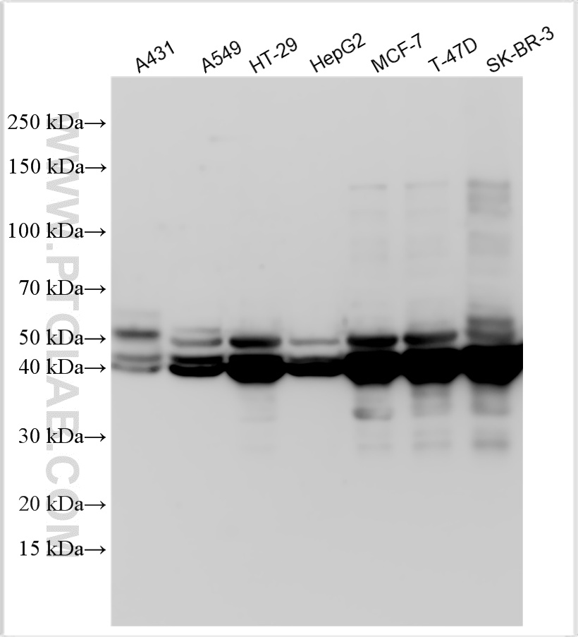 Western Blot (WB) analysis of various lysates using Cytokeratin 19 Polyclonal antibody (10712-1-AP)
