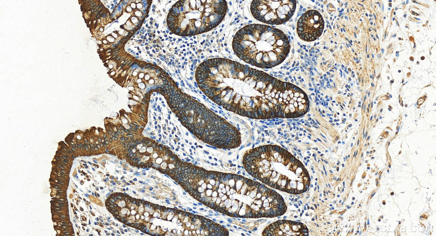 Immunohistochemistry (IHC) staining of human colon tissue using Cytokeratin 19 Polyclonal antibody (14965-1-AP)