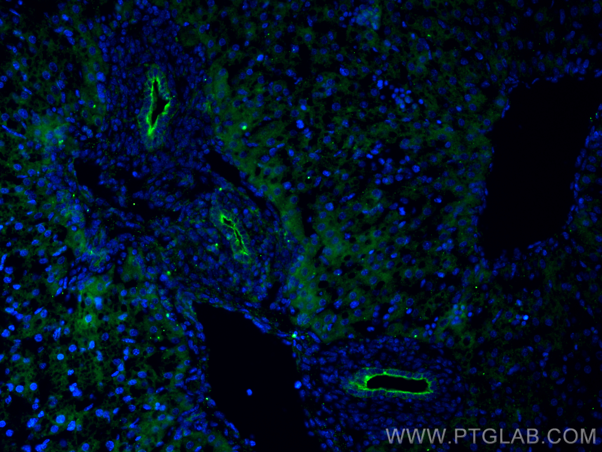 Immunofluorescence (IF) / fluorescent staining of mouse liver tissue using Cytokeratin 19 Polyclonal antibody (14965-1-AP)