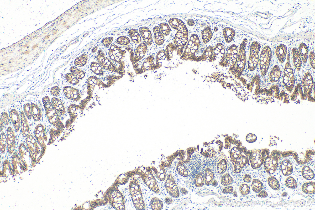 Immunohistochemistry (IHC) staining of rat colon tissue using Cytokeratin 19 Polyclonal antibody (14965-1-AP)