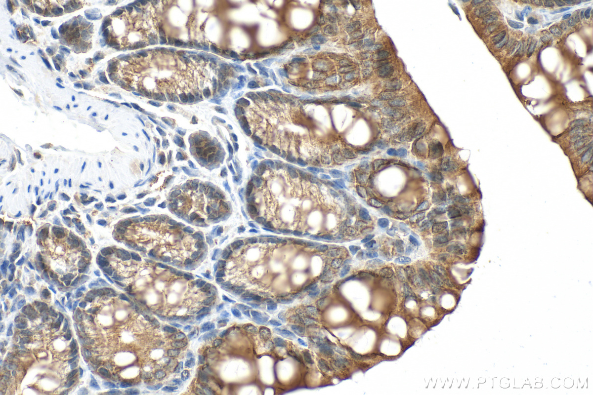 Immunohistochemistry (IHC) staining of mouse colon tissue using Cytokeratin 19 Polyclonal antibody (14965-1-AP)