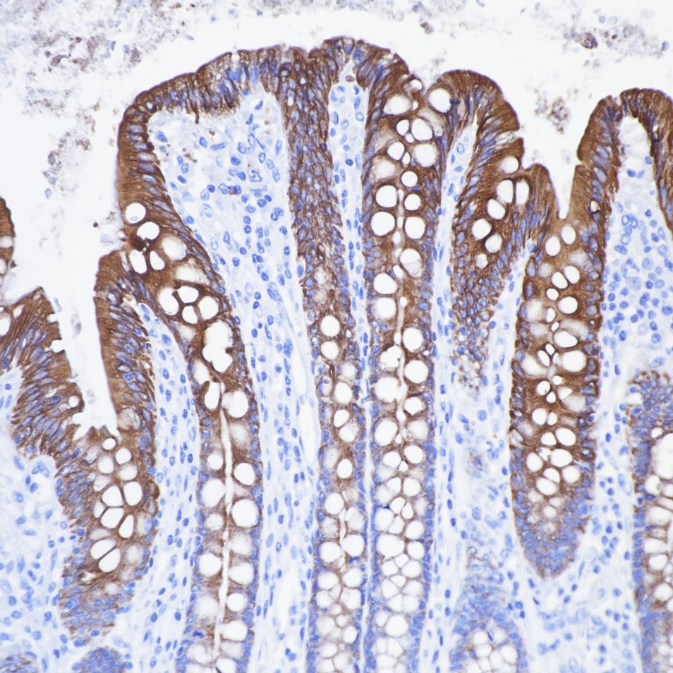 Immunohistochemistry (IHC) staining of human colon tissue using Cytokeratin 19 Monoclonal antibody (60187-1-Ig)