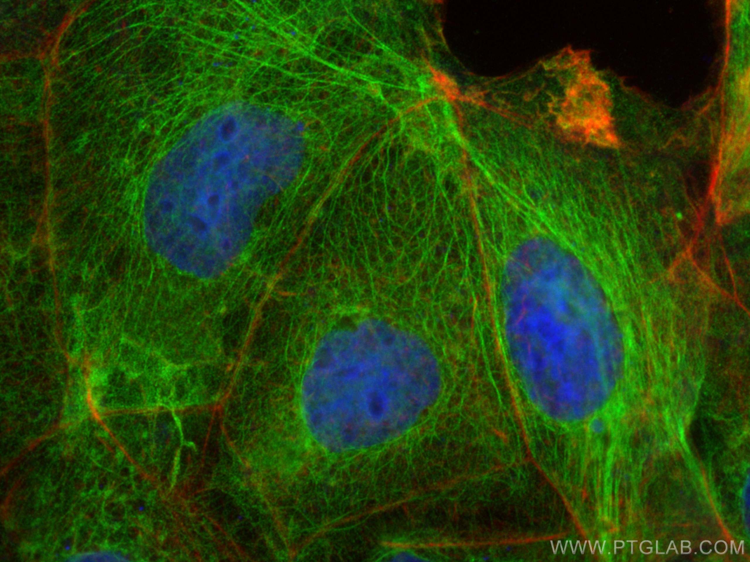 Immunofluorescence (IF) / fluorescent staining of Caco-2 cells using Cytokeratin 20 Polyclonal antibody (17329-1-AP)