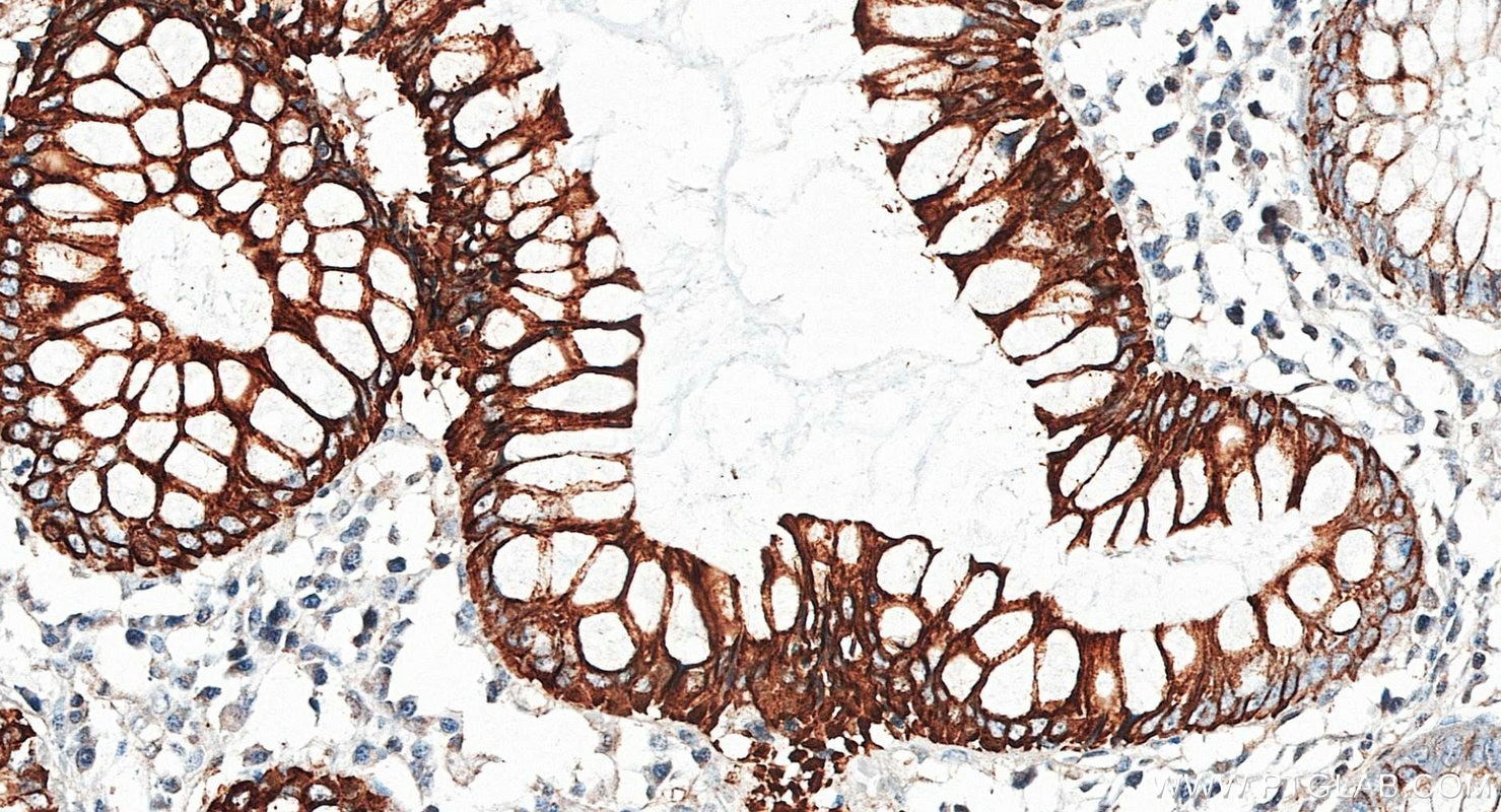 Immunohistochemistry (IHC) staining of human colon tissue using Cytokeratin 20 Polyclonal antibody (17329-1-AP)