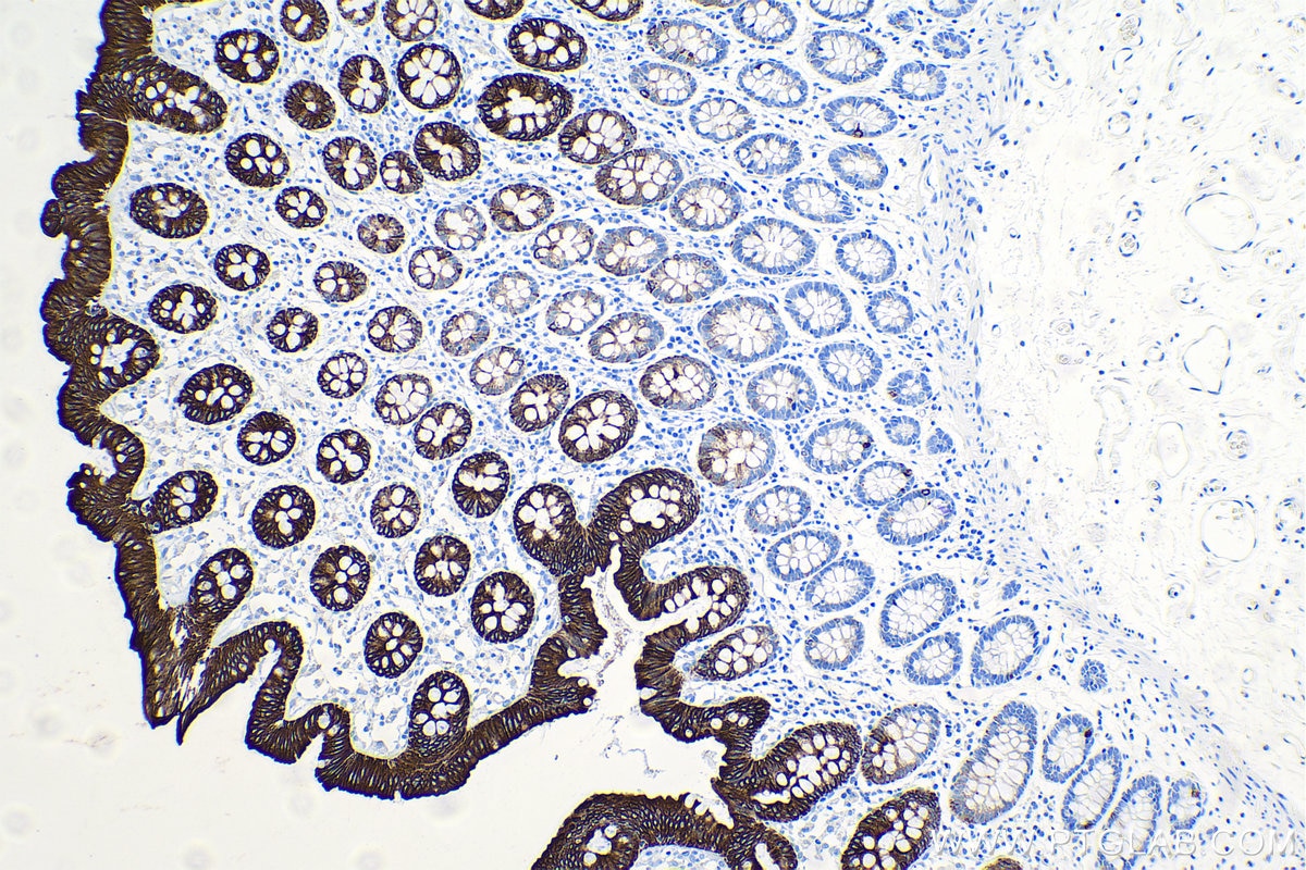 Immunohistochemistry (IHC) staining of human colon tissue using Cytokeratin 20 Monoclonal antibody (60183-1-Ig)