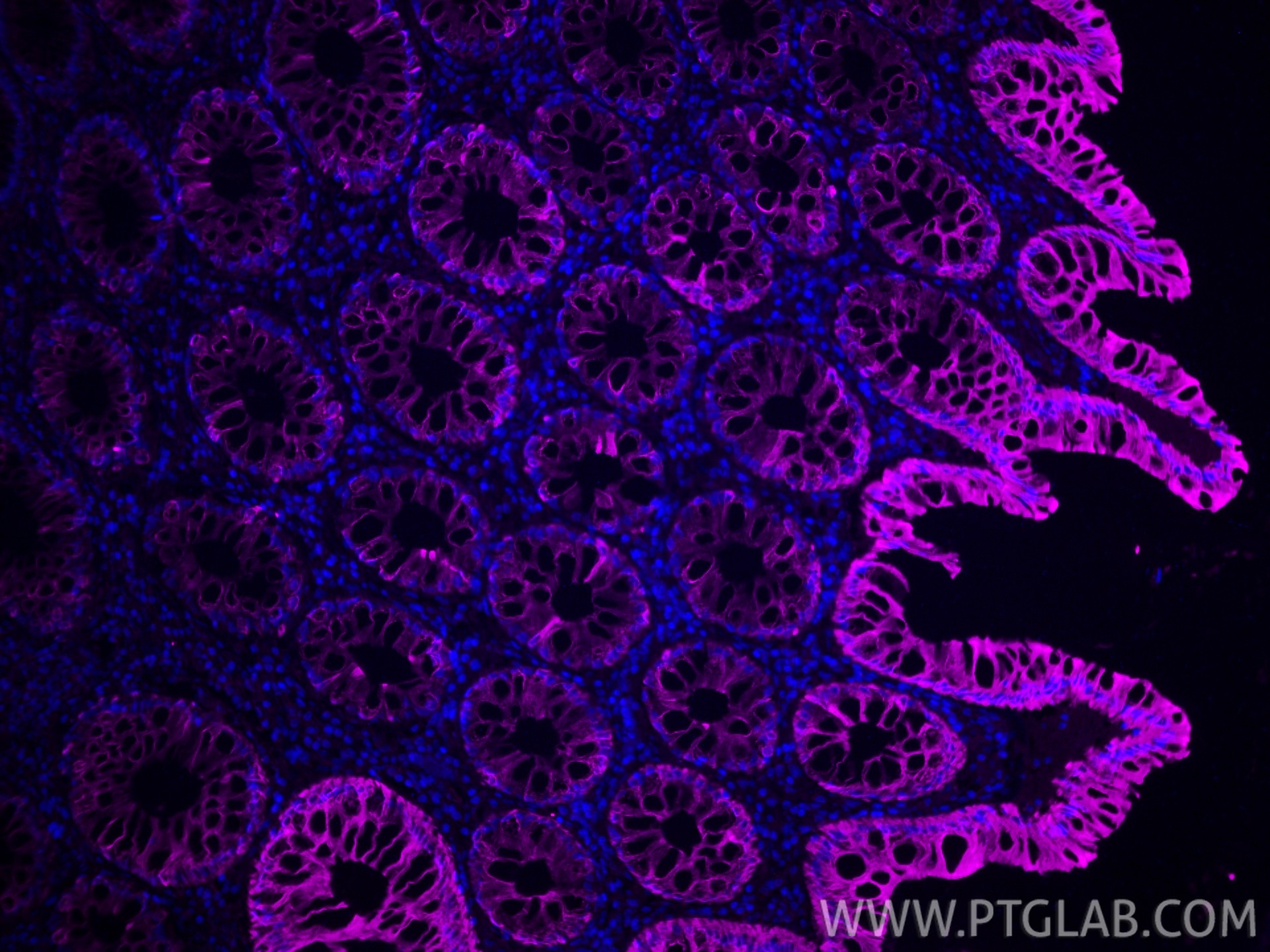 Immunofluorescence (IF) / fluorescent staining of human colon tissue using Cytokeratin 20 Recombinant monoclonal antibody (82428-1-RR)