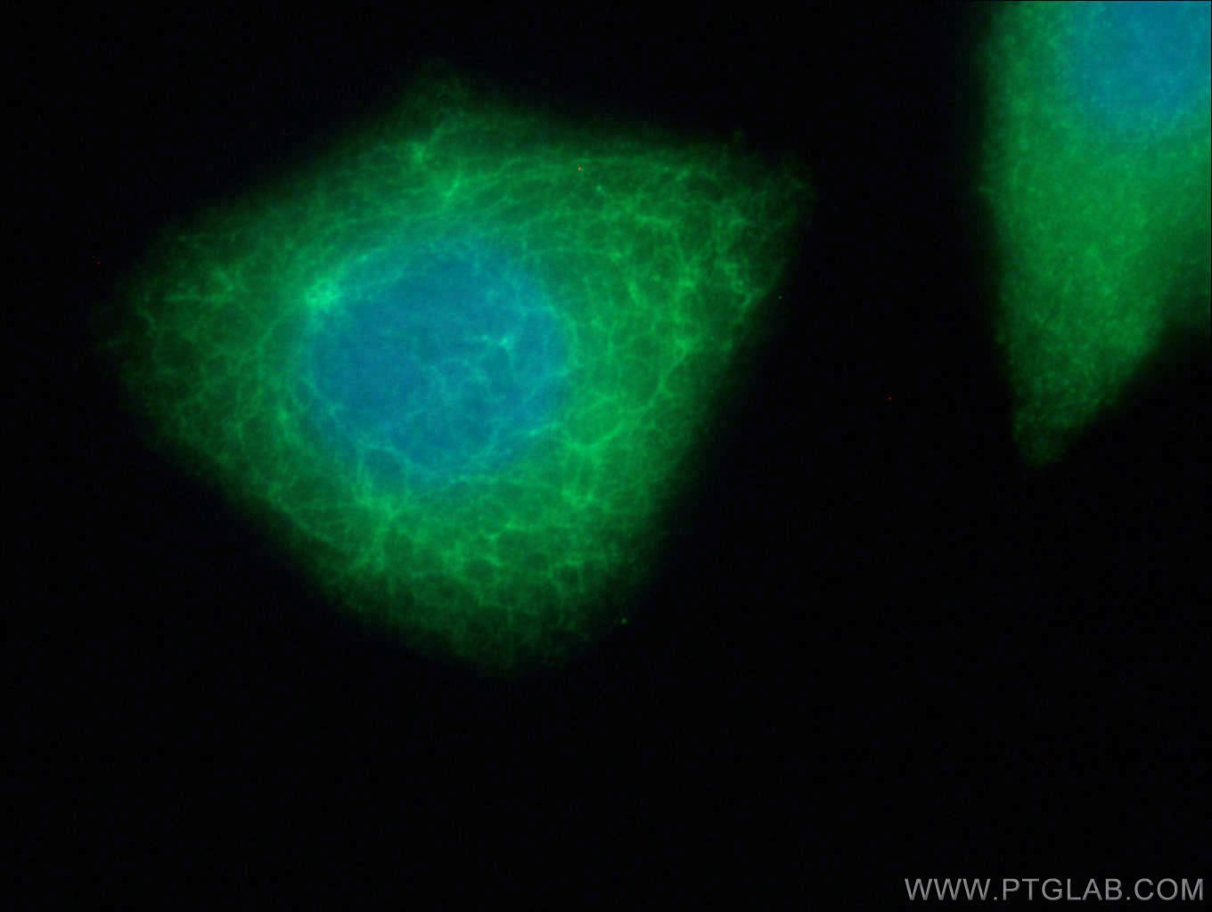 Immunofluorescence (IF) / fluorescent staining of HepG2 cells using KRT34 Polyclonal antibody (20449-1-AP)