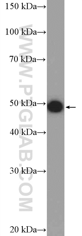 Western Blot (WB) analysis of A431 cells using KRT34 Polyclonal antibody (20449-1-AP)