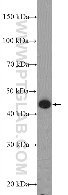 Western Blot (WB) analysis of HeLa cells using KRT34 Polyclonal antibody (20449-1-AP)