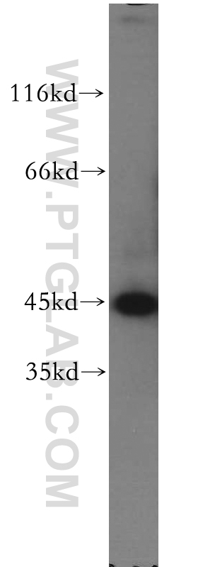 Western Blot (WB) analysis of L02 cells using KRT34 Polyclonal antibody (20449-1-AP)