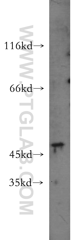 Western Blot (WB) analysis of A375 cells using KRT34 Polyclonal antibody (20449-1-AP)