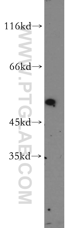 Western Blot (WB) analysis of mouse skin tissue using KRT34 Polyclonal antibody (20449-1-AP)