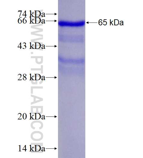 KRT34 fusion protein Ag14295 SDS-PAGE