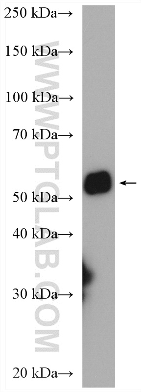 Western Blot (WB) analysis of human saliva using Cytokeratin 6A-specific Polyclonal antibody (16853-1-AP)