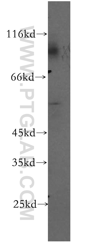 Western Blot (WB) analysis of mouse skin tissue using Cytokeratin 6A-specific Polyclonal antibody (16853-1-AP)