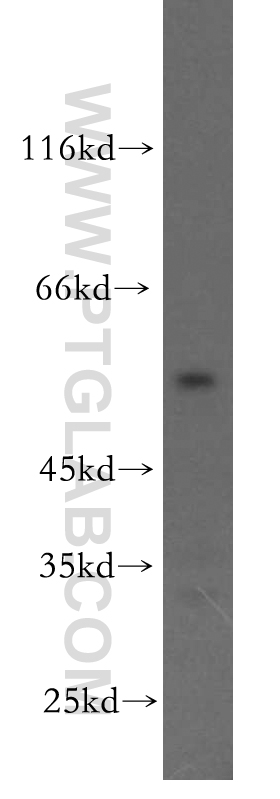 Western Blot (WB) analysis of HeLa cells using Cytokeratin 6A-specific Polyclonal antibody (16853-1-AP)