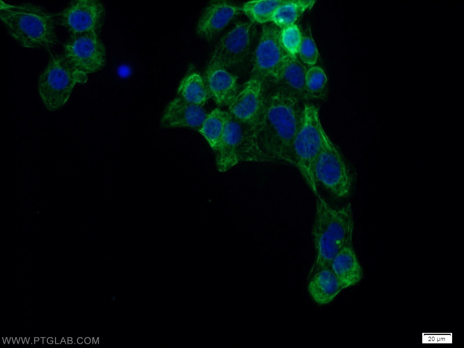 Cytokeratin 6A antibody (10590-1-AP) | Proteintech