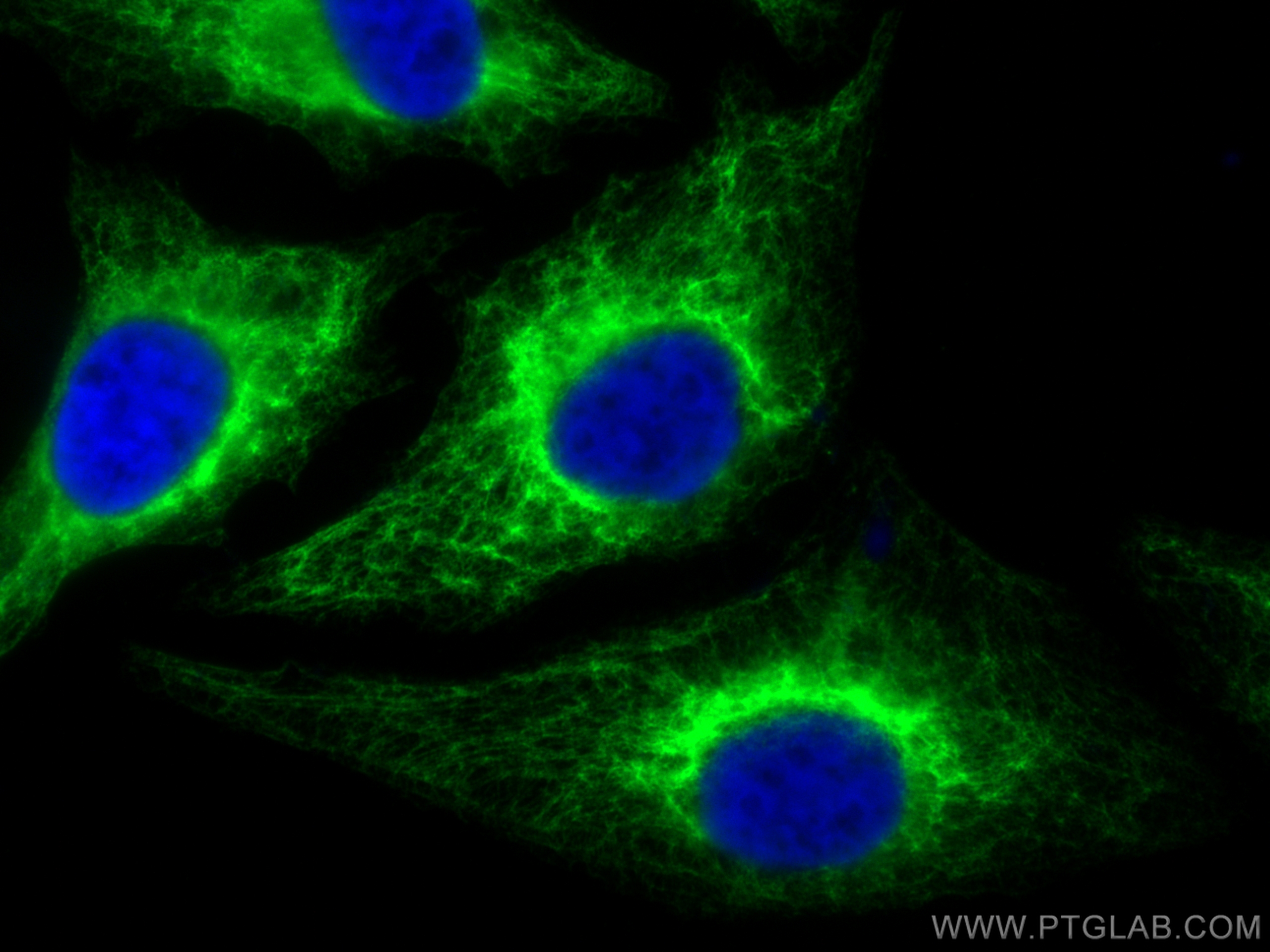 Immunofluorescence (IF) / fluorescent staining of HeLa cells using Cytokeratin 7 Polyclonal antibody (15539-1-AP)