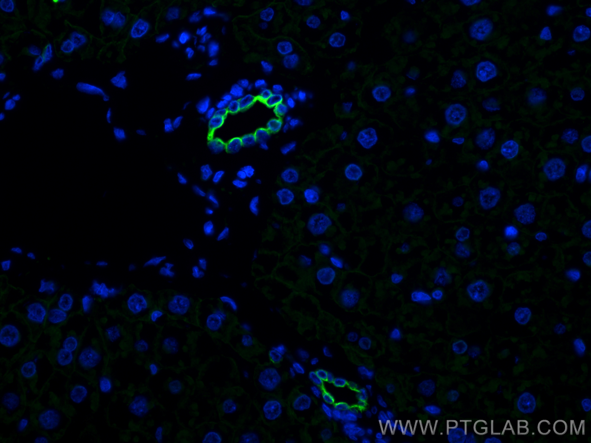 Immunofluorescence (IF) / fluorescent staining of rat liver tissue using Cytokeratin 7 Polyclonal antibody (15539-1-AP)