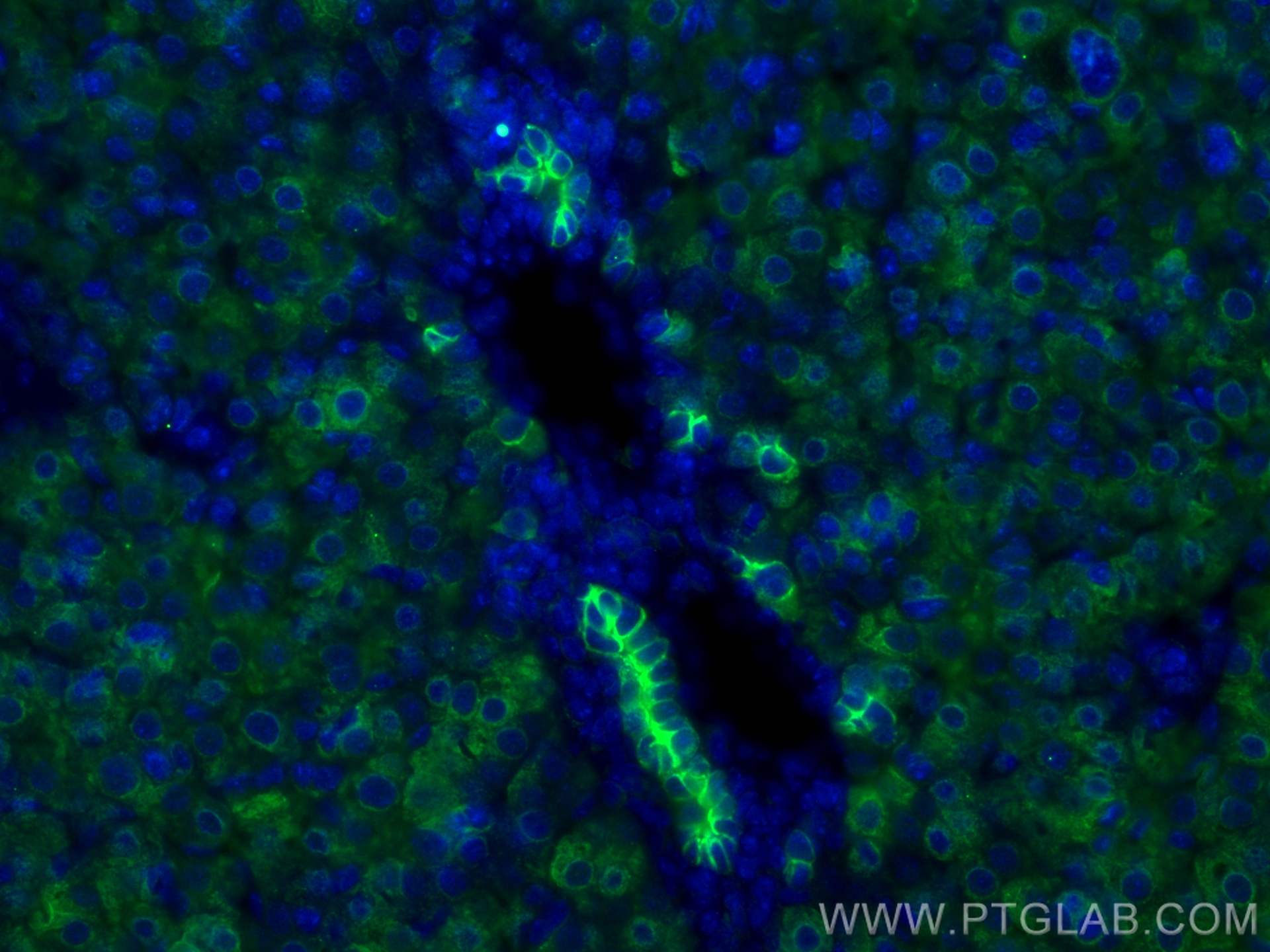 Immunofluorescence (IF) / fluorescent staining of mouse liver tissue using Cytokeratin 7 Polyclonal antibody (22208-1-AP)