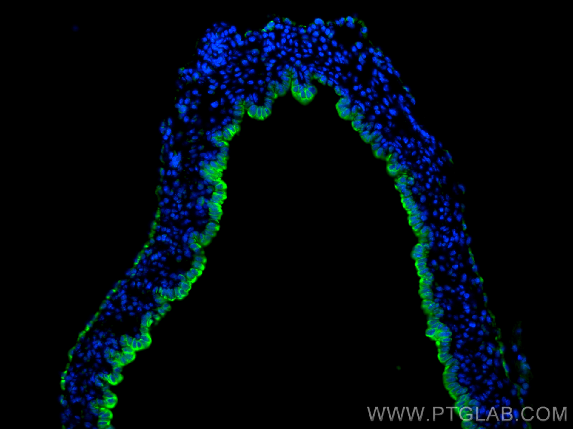 Immunofluorescence (IF) / fluorescent staining of mouse liver tissue using Cytokeratin 7-specific Polyclonal antibody (17513-1-AP)