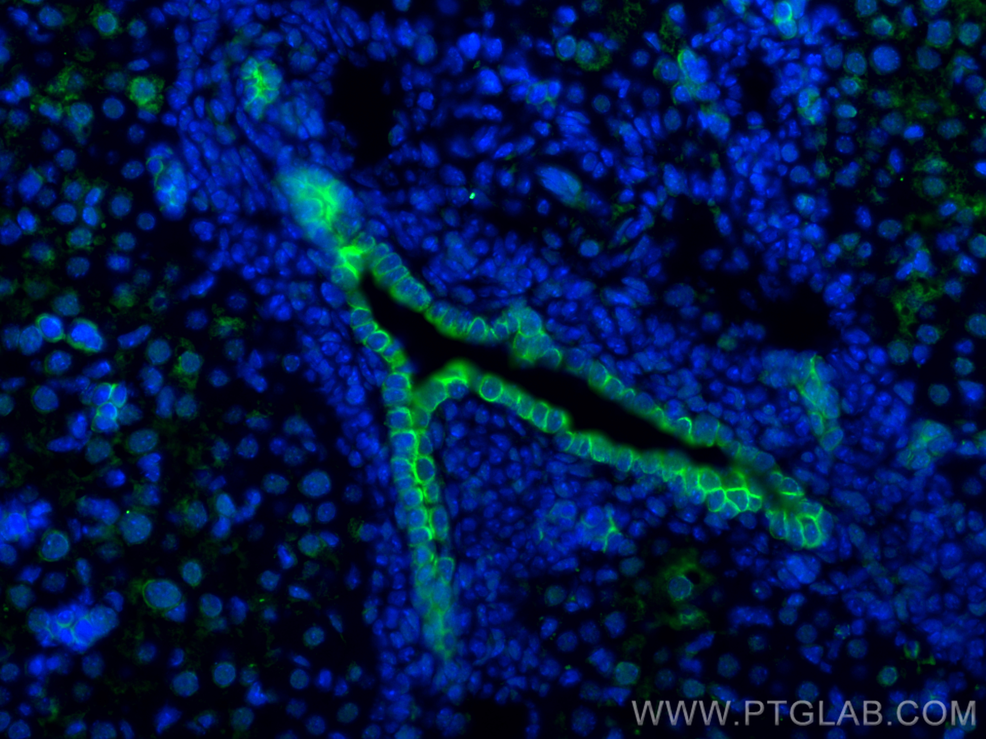 Immunofluorescence (IF) / fluorescent staining of mouse liver tissue using Cytokeratin 7-specific Polyclonal antibody (17513-1-AP)