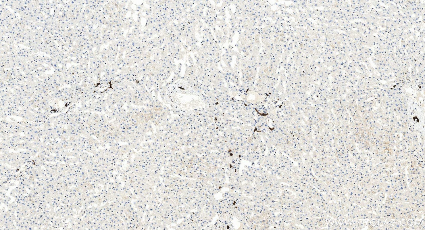 Immunohistochemistry (IHC) staining of human liver tissue using Cytokeratin 7-specific Polyclonal antibody (17513-1-AP)