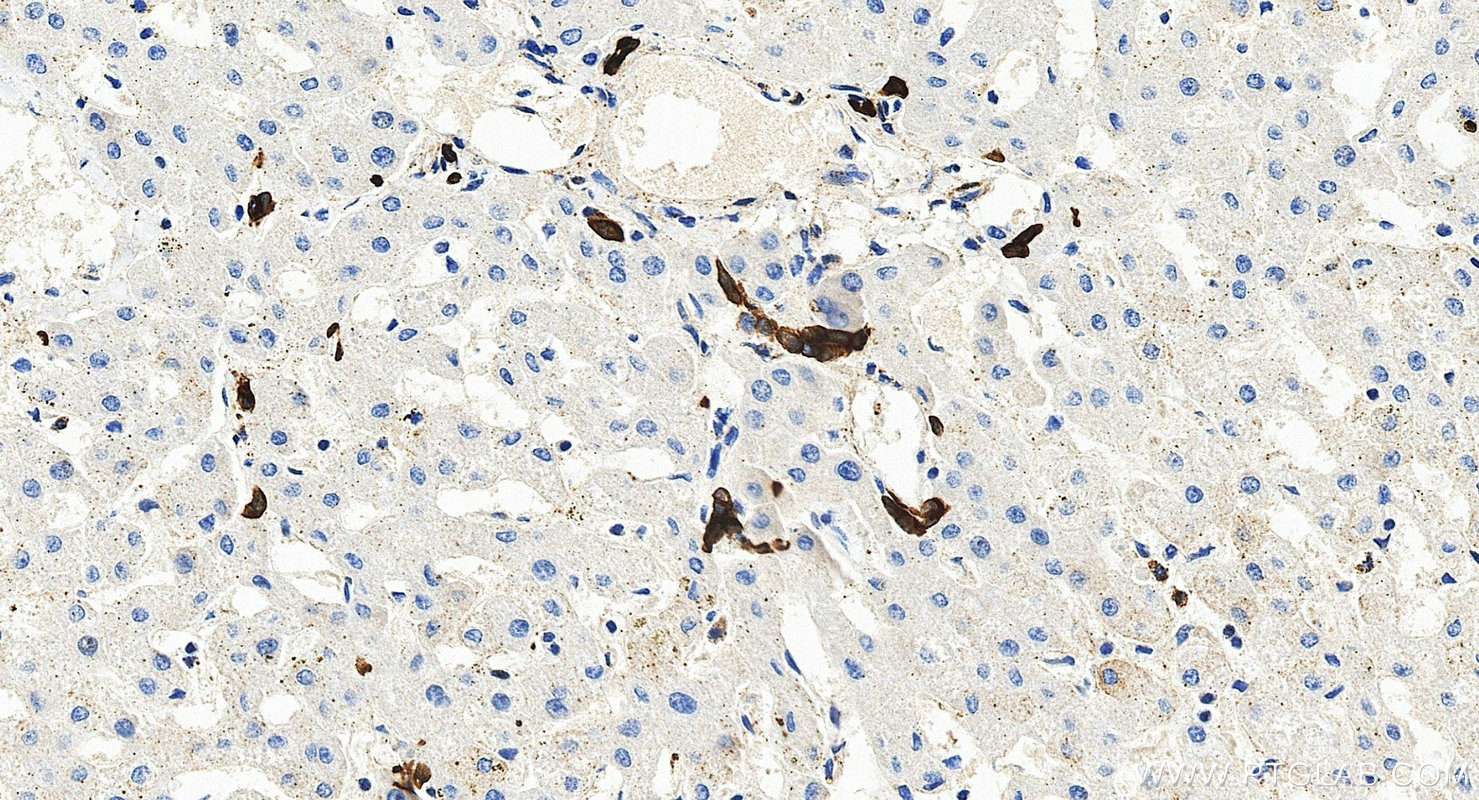 Immunohistochemistry (IHC) staining of human liver tissue using Cytokeratin 7-specific Polyclonal antibody (17513-1-AP)