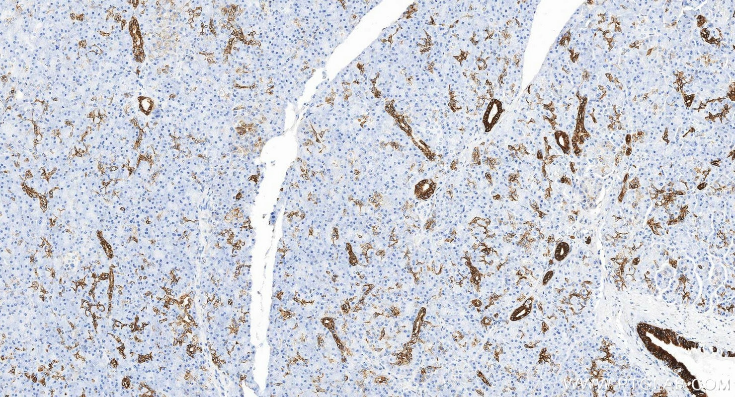 Immunohistochemistry (IHC) staining of human pancreas tissue using Cytokeratin 7-specific Polyclonal antibody (17513-1-AP)