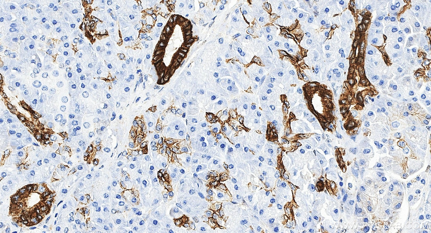 Immunohistochemistry (IHC) staining of human pancreas tissue using Cytokeratin 7-specific Polyclonal antibody (17513-1-AP)