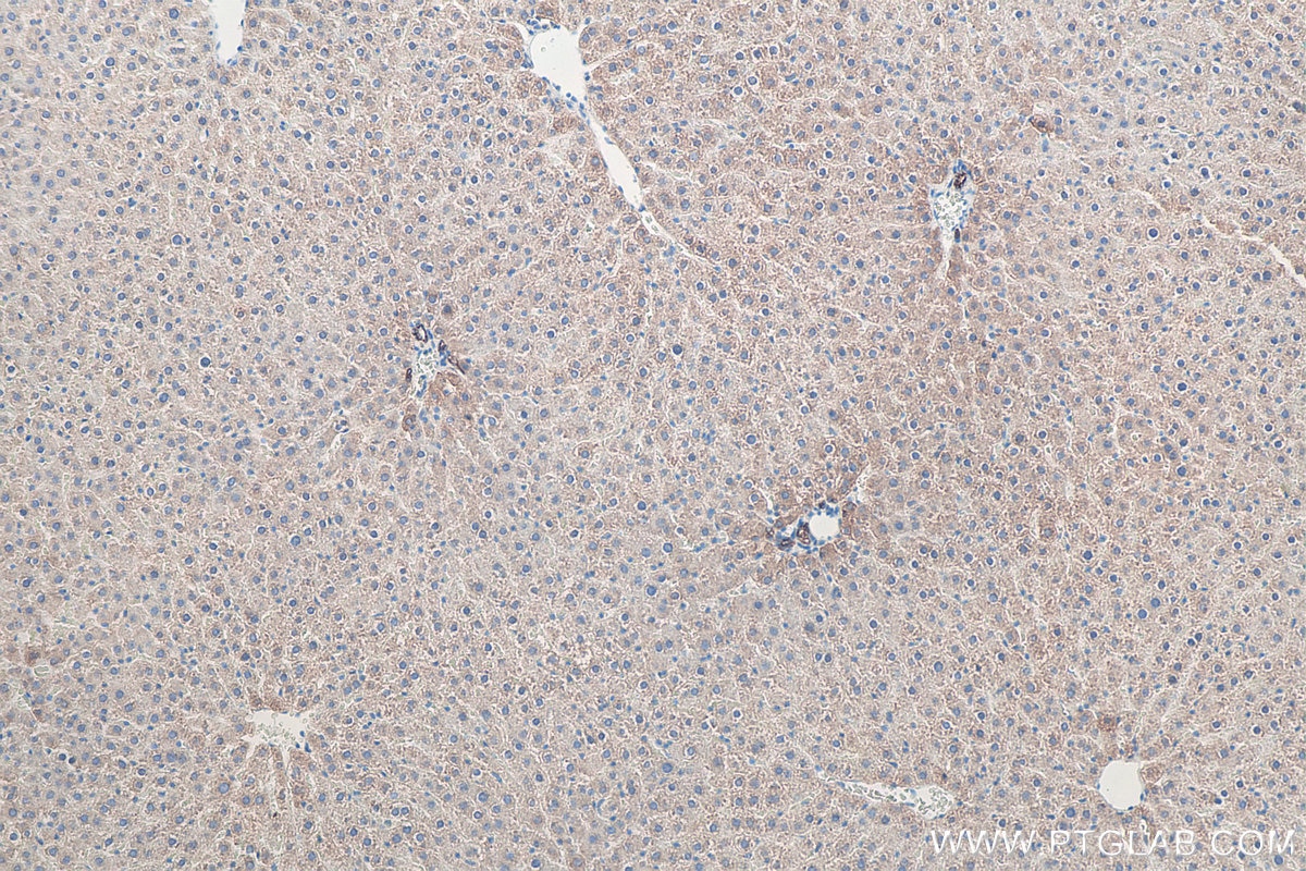 Immunohistochemistry (IHC) staining of rat liver tissue using Cytokeratin 8 Polyclonal antibody (10384-1-AP)