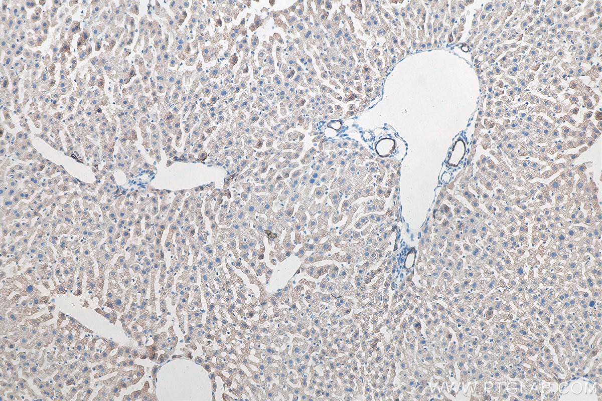 Immunohistochemistry (IHC) staining of mouse liver tissue using Cytokeratin 8 Polyclonal antibody (10384-1-AP)