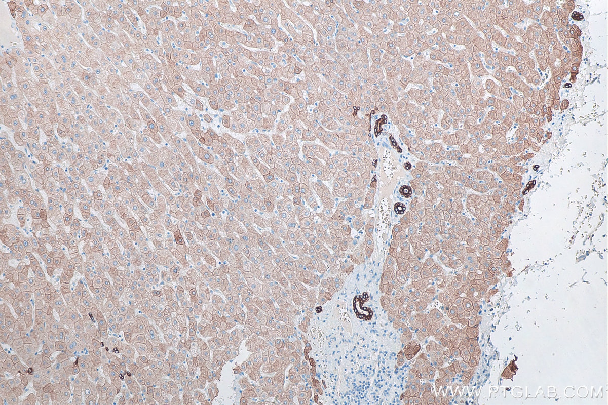 Immunohistochemistry (IHC) staining of human liver tissue using Cytokeratin 8 Polyclonal antibody (10384-1-AP)
