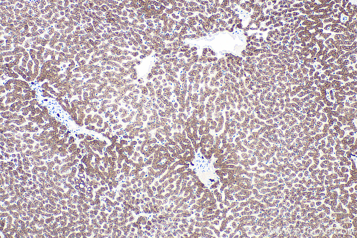 Immunohistochemistry (IHC) staining of human liver tissue using Cytokeratin 8 Polyclonal antibody (10384-1-AP)